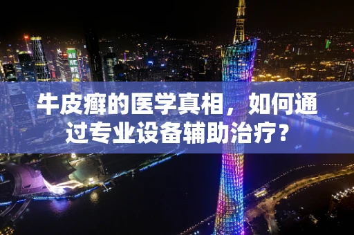 牛皮癣的医学真相，如何通过专业设备辅助治疗？